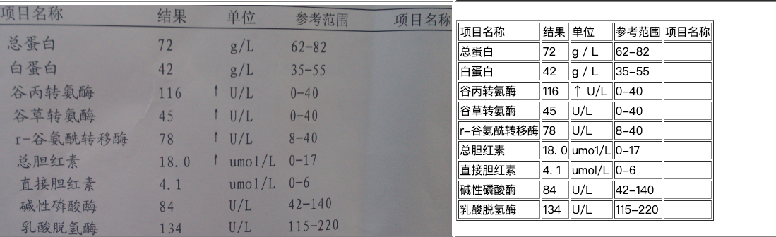 ppstructure/docs/imgs/table_ch_result3.jpg