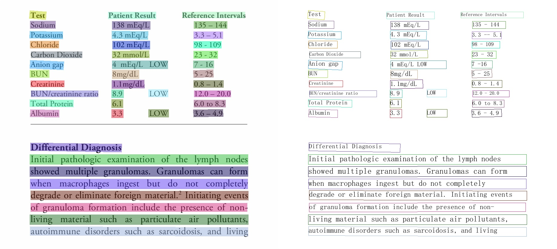 doc/imgs_results/PP-OCRv3/en/en_2.png